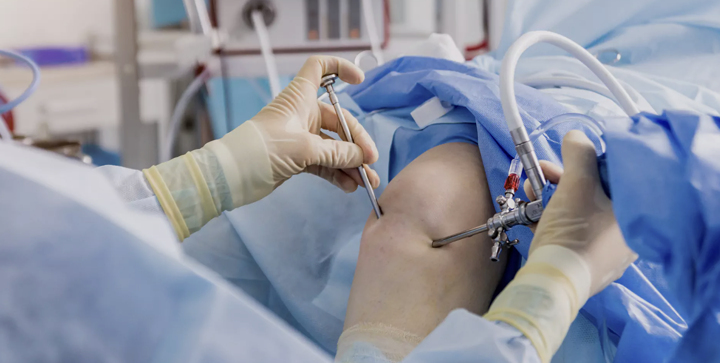 Arthroscopy